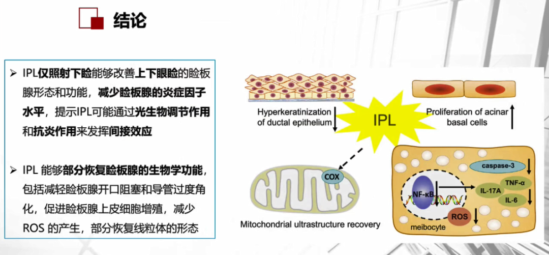 EYESIS强脉冲光具有光生物调节作用