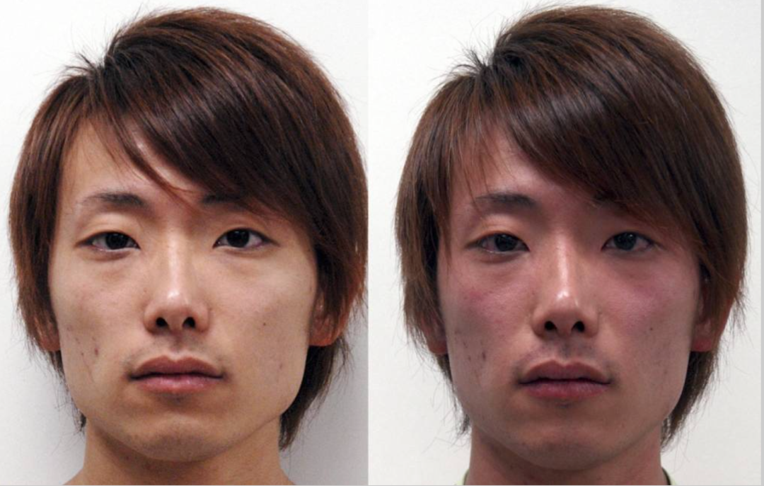 基因检测全是野生型好是不好_基因检查结果野生型什么意思_基因检测野生型什么意思