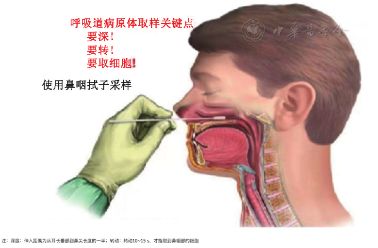 喉咙长茧表情包图片