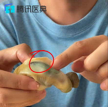 生蚝里面黑色的像屎一样的能吃吗_狗自己的屎不吃 吃别的狗的屎_生蚝里面什么样子