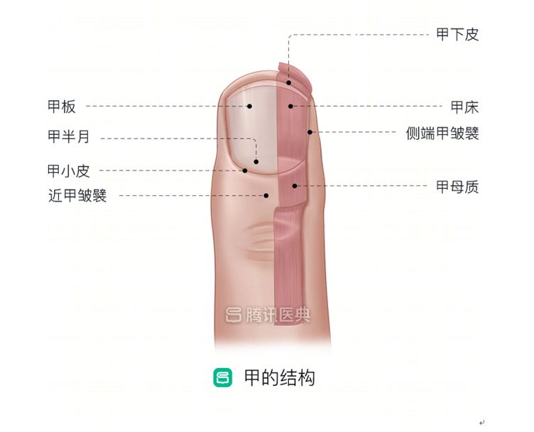 指甲上長出了腫瘤！這3種預兆，很多人後悔沒早點發現！ 健康 第8張