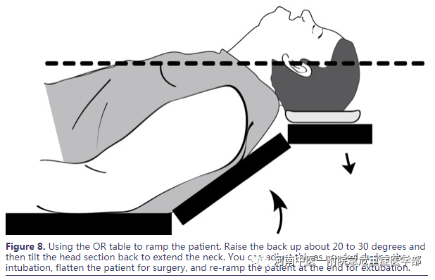 喉镜镜片怎么选困难气道的10项原则_https://www.jmylbn.com_新闻资讯_第16张