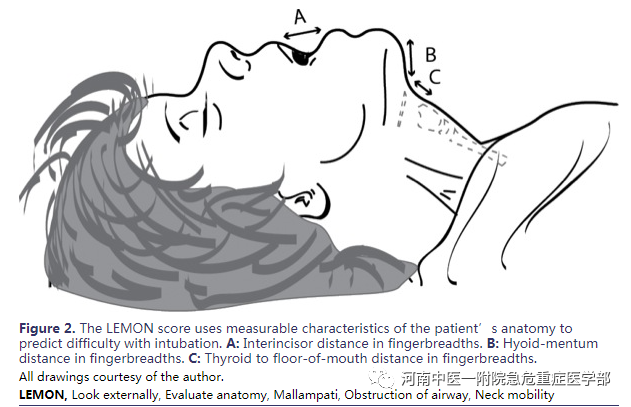 喉镜镜片怎么选困难气道的10项原则_https://www.jmylbn.com_新闻资讯_第5张