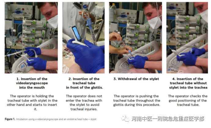 为什么购买可视硬性喉镜COVID-19之后，可视喉镜将成为气管插管操作的金标准？_https://www.jmylbn.com_新闻资讯_第3张