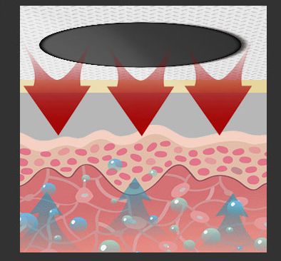 轉眼又到三伏天，冬病夏治，千萬別錯過！