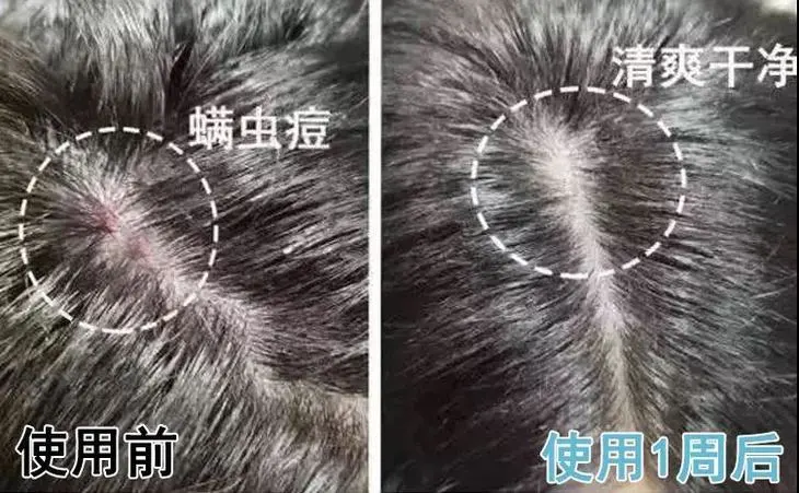 螨虫咬人后症状图片_被子里的螨虫咬人吗_怎么判断是螨虫咬的包