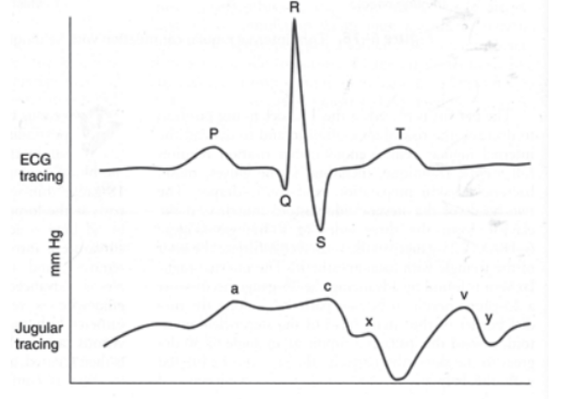 中心导管怎么使用中心静脉置管的方方面面_https://www.jmylbn.com_新闻资讯_第7张