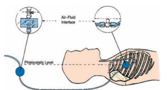中心导管怎么使用中心静脉置管的方方面面_https://www.jmylbn.com_新闻资讯_第8张