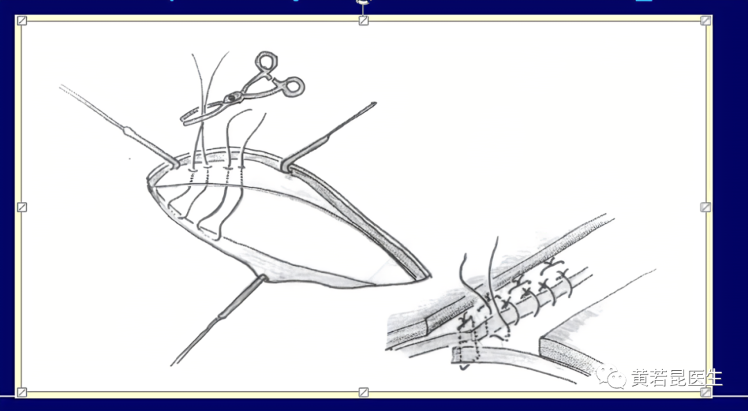 Pantsovervest 修复！德医学院助力医学教育发展！