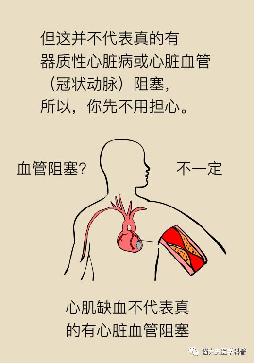 心電圖stt改變一定是心臟供血不足嗎