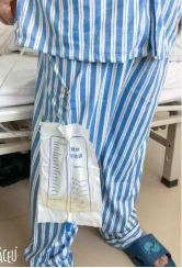 留置引流导管是什么【科普】留置尿管知多少_https://www.jmylbn.com_新闻资讯_第3张