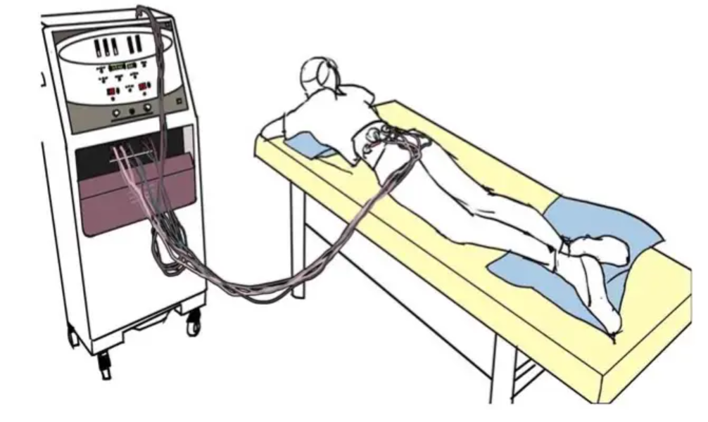 什么是中频干扰中频电疗神器——干扰电疗法_https://www.jmylbn.com_新闻资讯_第4张