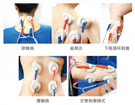 中频为什么能镇痛什么？中低频治疗会有如此多的治疗作用_https://www.jmylbn.com_新闻资讯_第11张