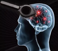 tms什么医疗经颅磁刺激—治疗之外的价值_https://www.jmylbn.com_新闻资讯_第2张