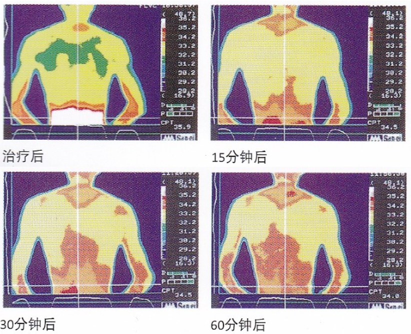 磁振热治疗仪怎么用一种功效三合一的新型干预手段——磁振热疗法_https://www.jmylbn.com_新闻资讯_第12张