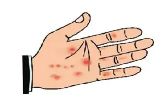 微波怎么治疗高频电疗法——微波疗法_https://www.jmylbn.com_新闻资讯_第6张