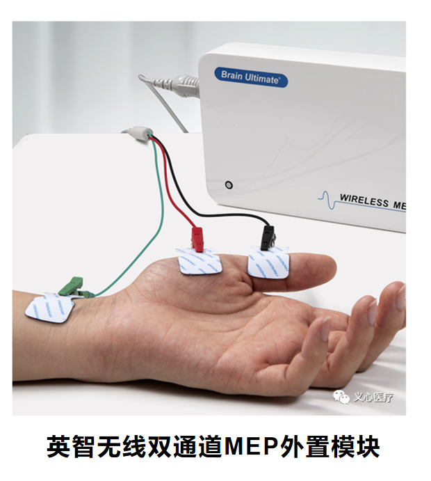 tms什么医疗经颅磁刺激—治疗之外的价值_https://www.jmylbn.com_新闻资讯_第14张