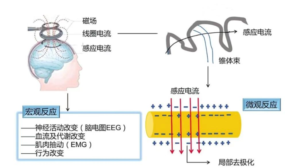 tms什么医疗经颅磁刺激—治疗之外的价值_https://www.jmylbn.com_新闻资讯_第24张