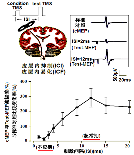 tms什么医疗经颅磁刺激—治疗之外的价值_https://www.jmylbn.com_新闻资讯_第19张