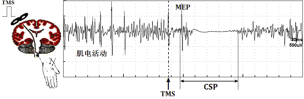 tms什么医疗经颅磁刺激—治疗之外的价值_https://www.jmylbn.com_新闻资讯_第17张