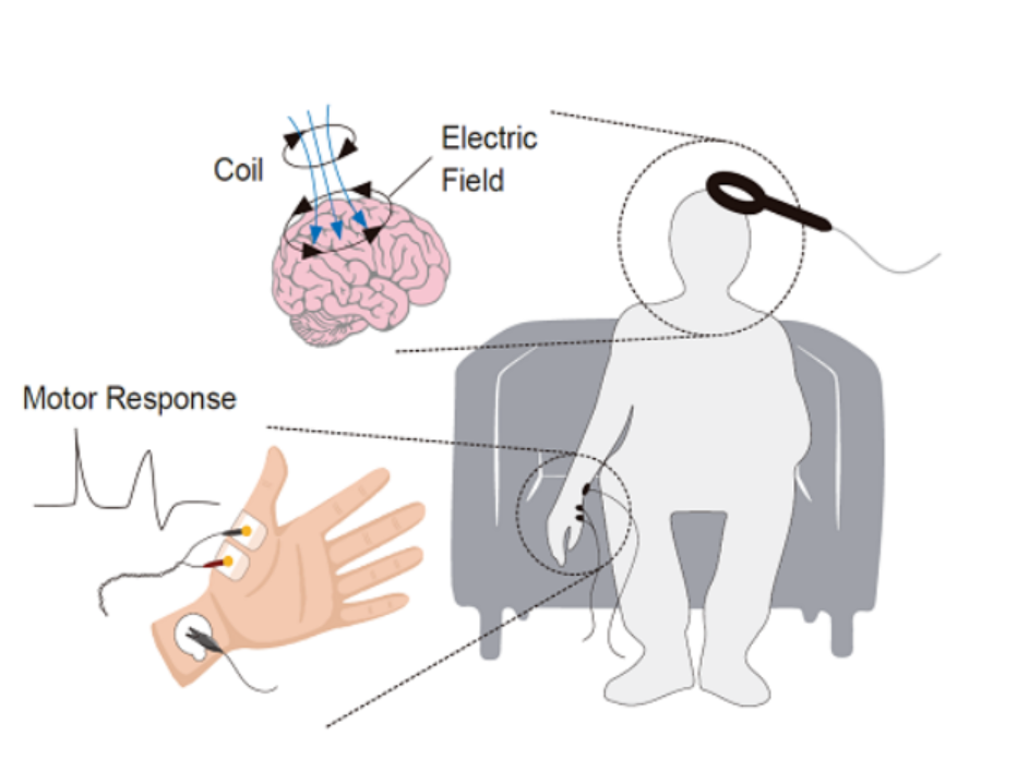 tms什么医疗经颅磁刺激—治疗之外的价值_https://www.jmylbn.com_新闻资讯_第11张