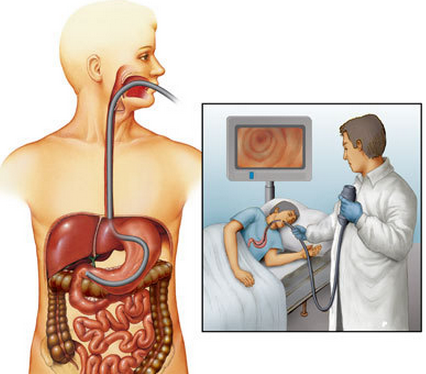 电子直肠镜怎么做做结直肠镜检查前，要做好哪些准备？_https://www.jmylbn.com_新闻资讯_第12张