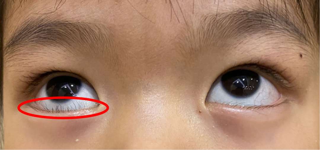 宝宝怕光流泪爱眨眼有可能是这个问题