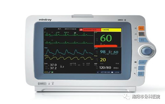 心电监护仪怎么看图解四张图带你了解监护仪_https://www.jmylbn.com_新闻资讯_第8张