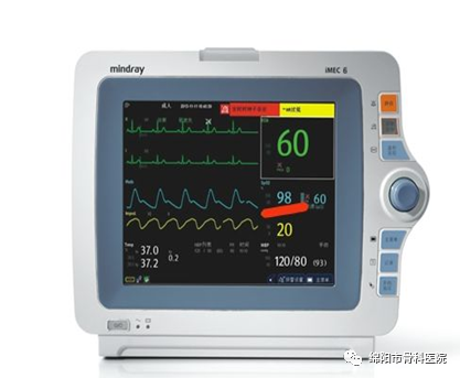 心电监护仪怎么看图解四张图带你了解监护仪_https://www.jmylbn.com_新闻资讯_第9张