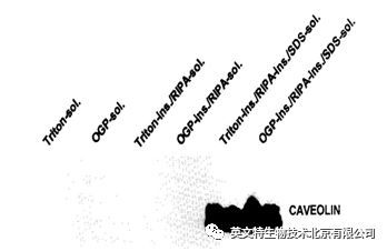 磷酸化蛋白 WB 做不好？原因竟有可能是因为......