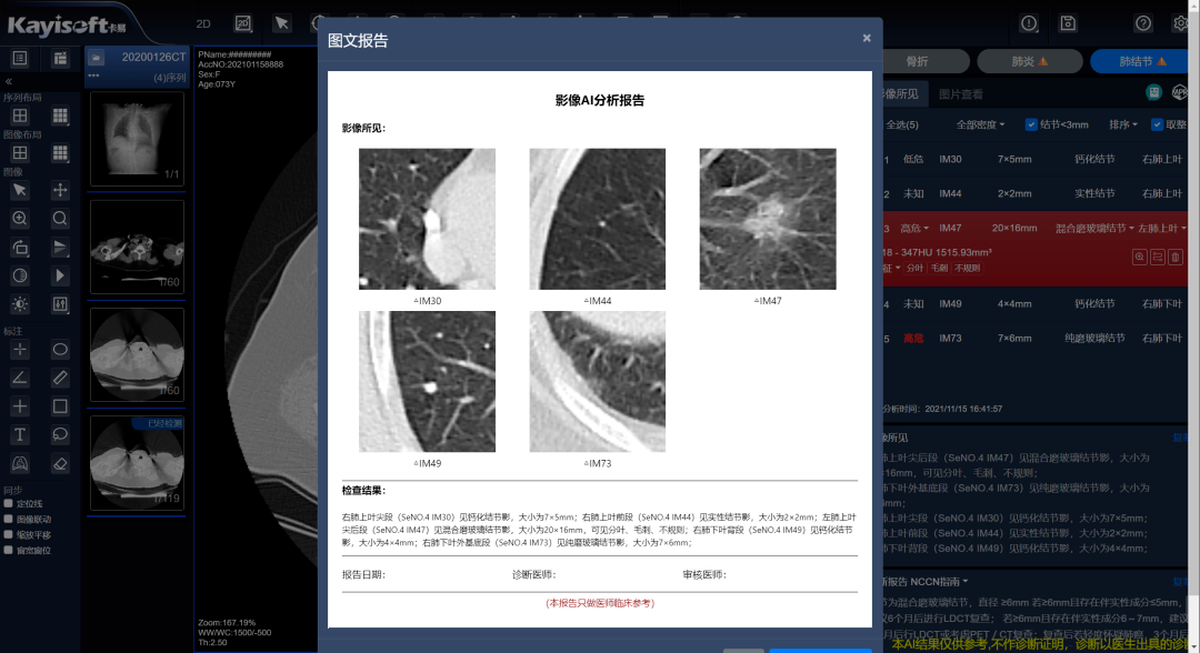 什么是数字肺【祝贺】“基于区域影像云的CT肺结节AI分析服务”荣获2023 CHITEC数字医疗健康创新服务案例_https://www.jmylbn.com_新闻资讯_第4张