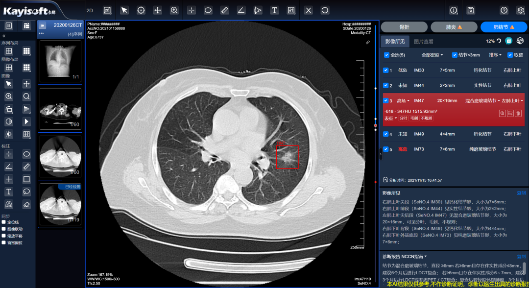什么是数字肺【祝贺】“基于区域影像云的CT肺结节AI分析服务”荣获2023 CHITEC数字医疗健康创新服务案例_https://www.jmylbn.com_新闻资讯_第3张