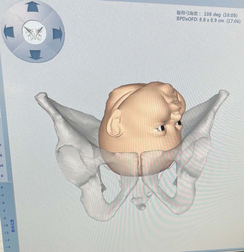 产程三维导航是什么分娩导航来帮忙，顺产不慌张！_https://www.jmylbn.com_新闻资讯_第6张