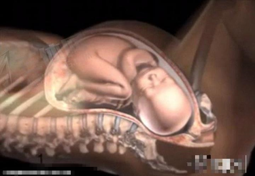 产程三维导航是什么分娩导航来帮忙，顺产不慌张！_https://www.jmylbn.com_新闻资讯_第2张