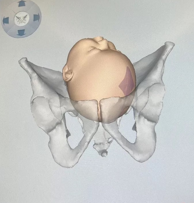 产程三维导航是什么分娩导航来帮忙，顺产不慌张！_https://www.jmylbn.com_新闻资讯_第4张