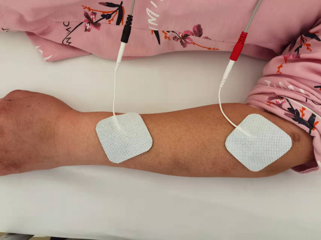 中频理疗怎么用理疗之中频电疗法_https://www.jmylbn.com_新闻资讯_第4张