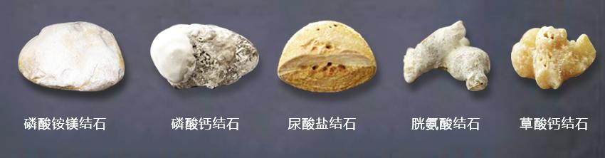 什么是输尿管镜健康科普丨输尿管软镜，让泌尿系结石“无处遁形”_https://www.jmylbn.com_新闻资讯_第4张