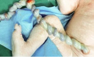 胎监是检查胎儿什么【24小时守护】胎监在家就能做，远程胎监保障胎儿宫内安危_https://www.jmylbn.com_新闻资讯_第4张