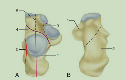 跟骨骨折如何轻松纠正内翻畸形，结合AO、坎贝尔、Rockwood、积水潭足踝外科经验总结及个人见解