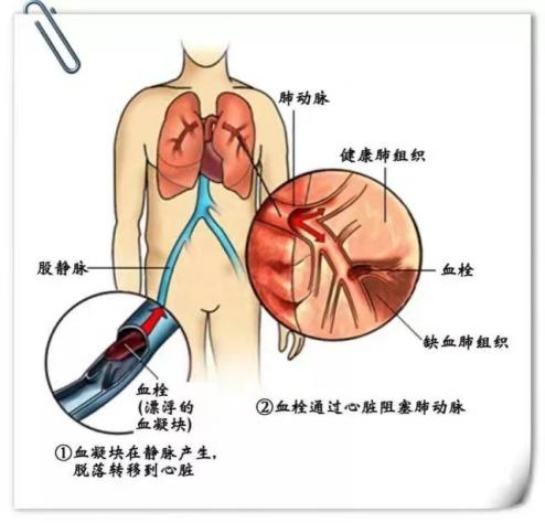 同型半氨酸怎么化验为什么要检测同型半胱氨酸_https://www.jmylbn.com_新闻资讯_第10张