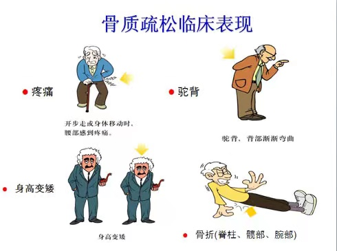 同型半氨酸怎么化验为什么要检测同型半胱氨酸_https://www.jmylbn.com_新闻资讯_第8张