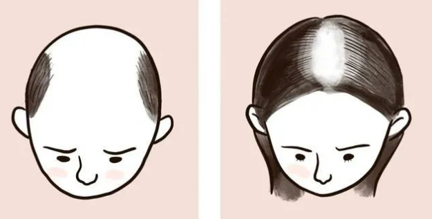 儿童也会脱发？孩子的“头”等大事慢不得！