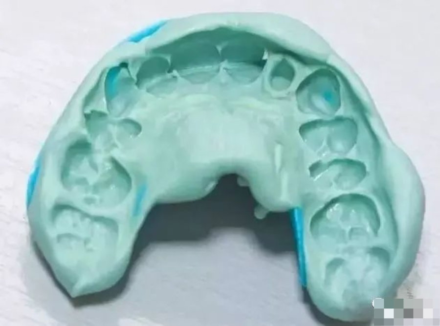 牙科材料硅胶怎么用【干货】简便式完美取模技巧（附牙体制备后双线排龈、硅橡胶取模实拍视频）_https://www.jmylbn.com_新闻资讯_第14张