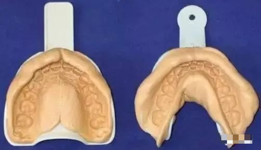 牙科材料硅胶怎么用【干货】简便式完美取模技巧（附牙体制备后双线排龈、硅橡胶取模实拍视频）_https://www.jmylbn.com_新闻资讯_第24张