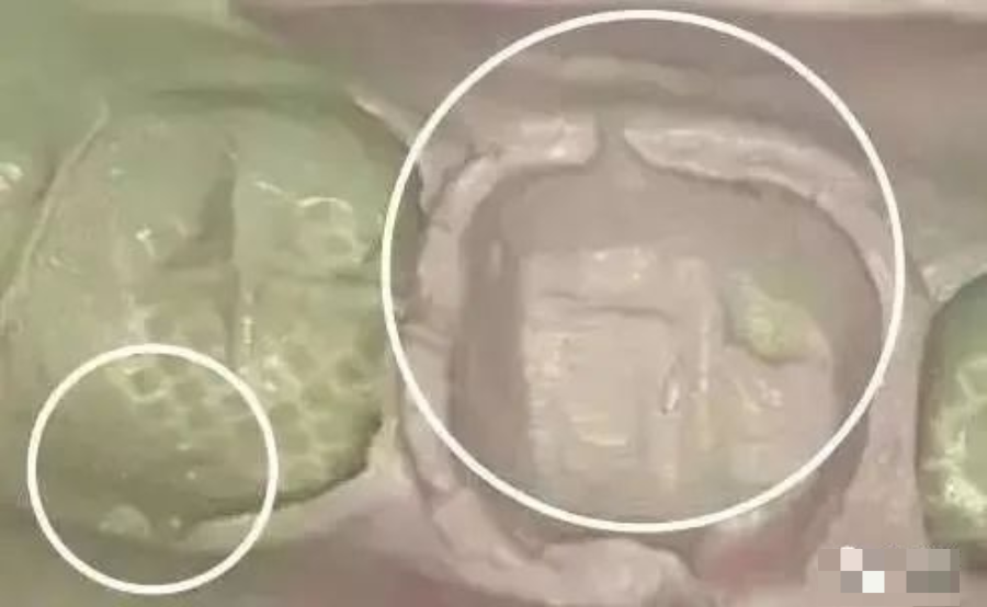 牙科材料硅胶怎么用【干货】简便式完美取模技巧（附牙体制备后双线排龈、硅橡胶取模实拍视频）_https://www.jmylbn.com_新闻资讯_第2张