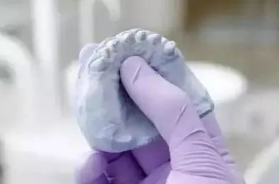 牙科材料硅胶怎么用【干货】简便式完美取模技巧（附牙体制备后双线排龈、硅橡胶取模实拍视频）_https://www.jmylbn.com_新闻资讯_第18张