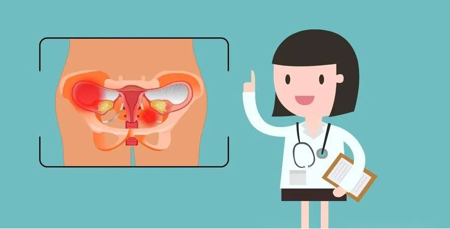 盆腔炎治疗仪怎么用盆腔炎、输卵管阻塞治疗新技术——永磁旋振治疗仪_https://www.jmylbn.com_新闻资讯_第4张