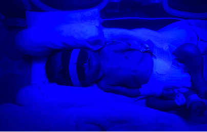 为什么新生儿抢救台早产儿护理更费心，这些知识学起来_https://www.jmylbn.com_新闻资讯_第7张