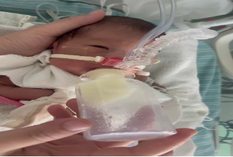 为什么新生儿抢救台早产儿护理更费心，这些知识学起来_https://www.jmylbn.com_新闻资讯_第6张