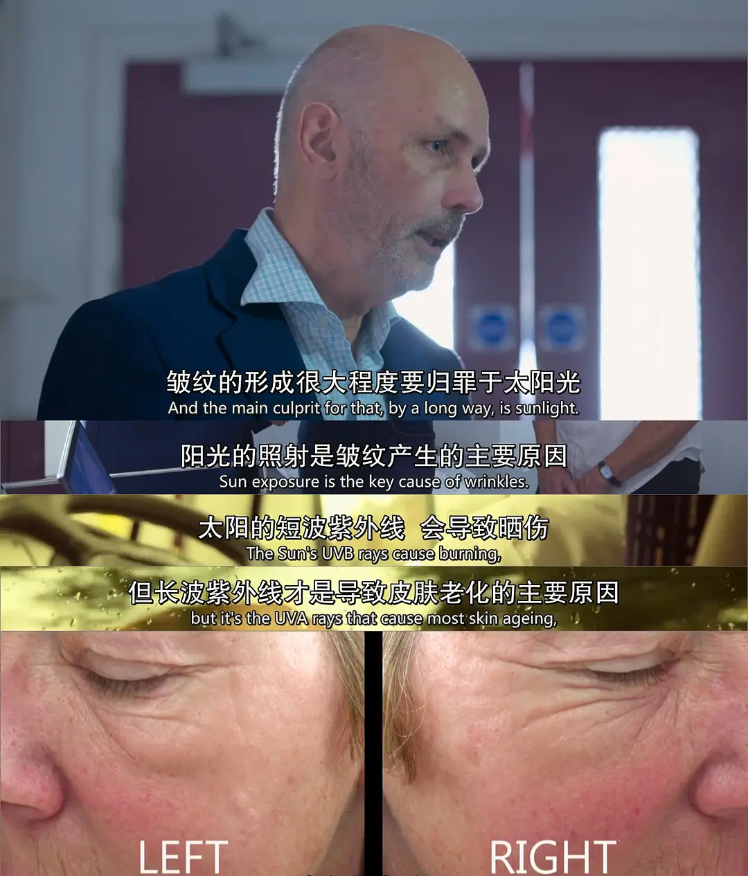 26岁干性皮肤女人如何保养护肤_去美容院做基础护肤有用吗_基础保养护肤品有哪些